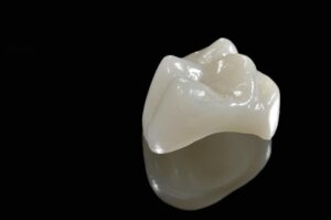 Porcelain Crown